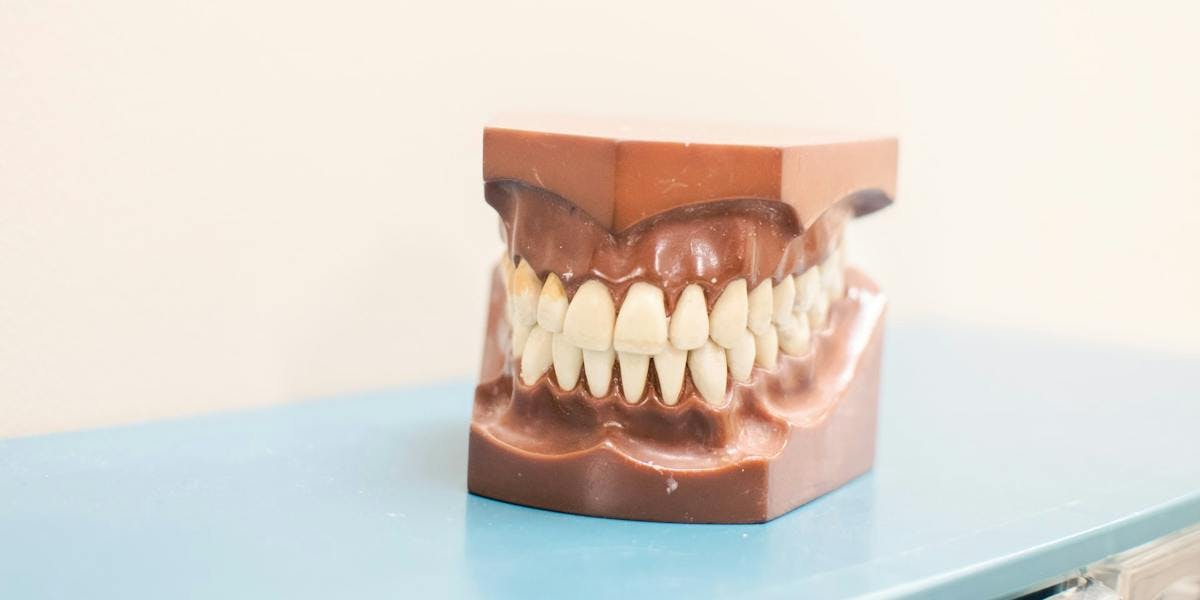 a dentist model of teeth